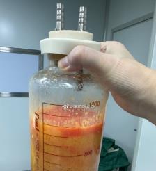 定边水动力吸脂手术要做多久？